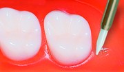 Soft-Tissue-Trimmer Soft-Tissue-Trimmer